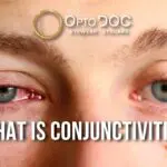 2025-01-27 What is Conjunctivitis by OptoDoc