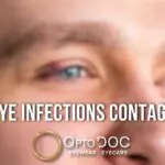 Are Eye Infections Contagious - Learn the Facts in 2025