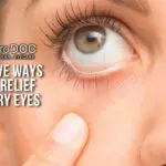Effective Ways To Get Relief From Dry Eyes - OptoDoc