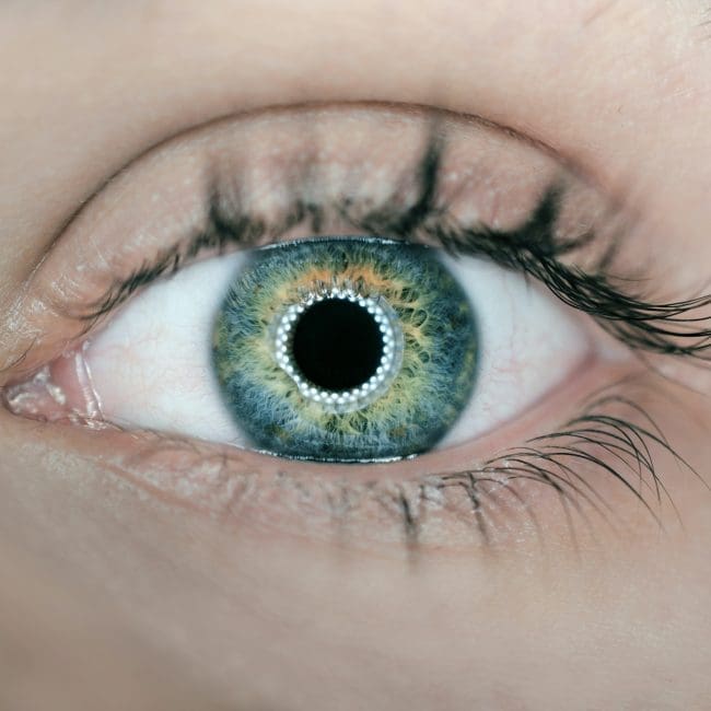 Medical Eye image - OptoDoc