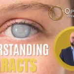 Understanding Cataracts Causes, Symptoms, and Treatment