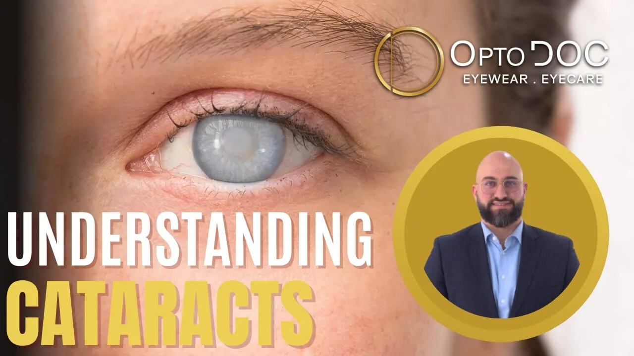 Understanding Cataracts Causes, Symptoms, and Treatment