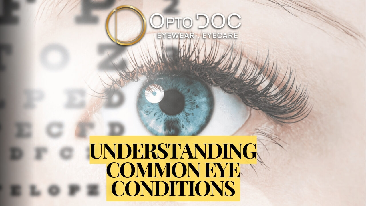 Understanding Common Eye Conditions - OptoDoc - July 2024