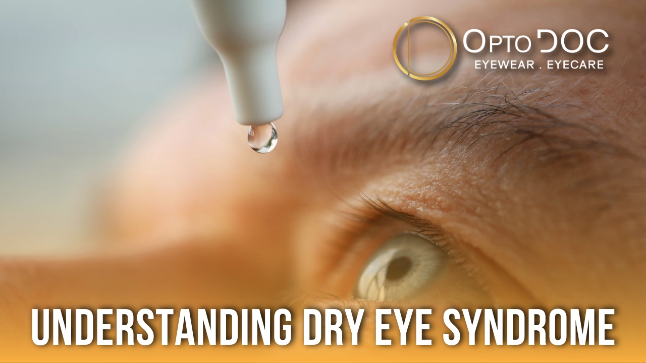 Understanding Dry Eye Syndrome Symptoms, Causes, and Treatment