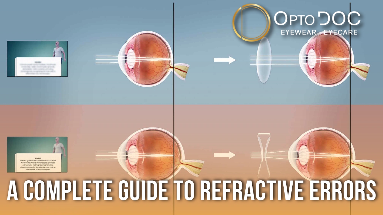 Your trusted source for eye health education from OptoDoc