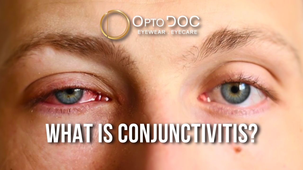 2025-01-27 What is Conjunctivitis by OptoDoc