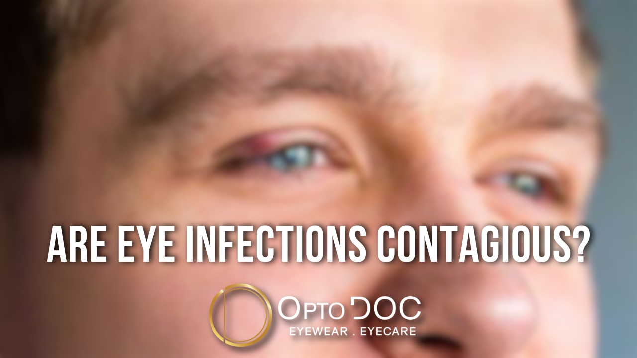 Are Eye Infections Contagious - Learn the Facts in 2025